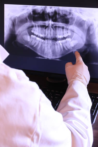 Best Emergency Wisdom Tooth Extraction in Ranchettes, WY
